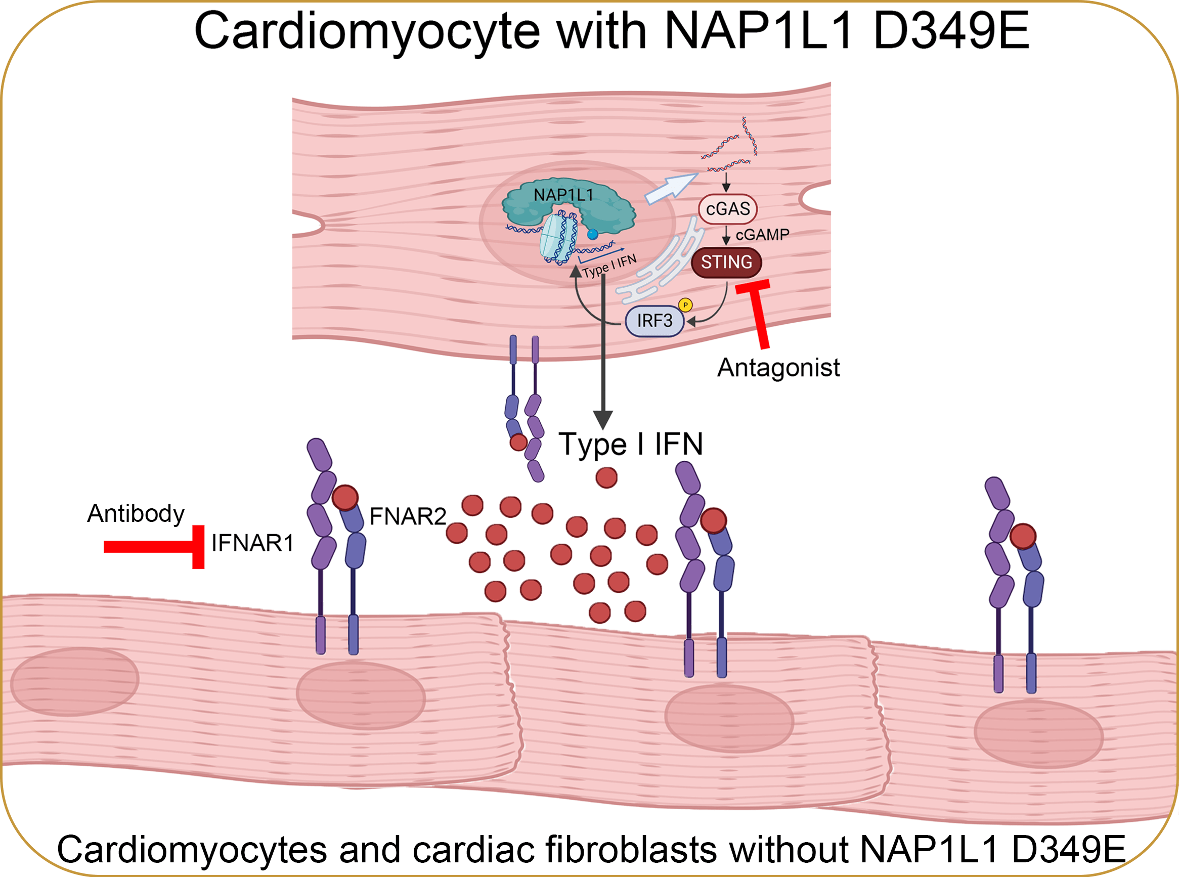 Hypertrophic Cardiomyopathy